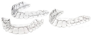 coastal orthodontics corpus christi ez-align